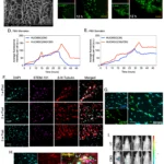 Conditioned medium-enriched umbilical cord mesenchymal stem cells: a potential therapeutic strategy for spinal cord injury, unveiling transcriptomic and secretomic insights