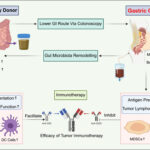 Exploring Fecal Microbiota Transplantation: Potential Benefits, Associated Risks, and Challenges in Cancer Treatment