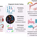 Y/15 Chromosomal Translocation in Turner Syndrome: A Case of Unexplained Short Stature